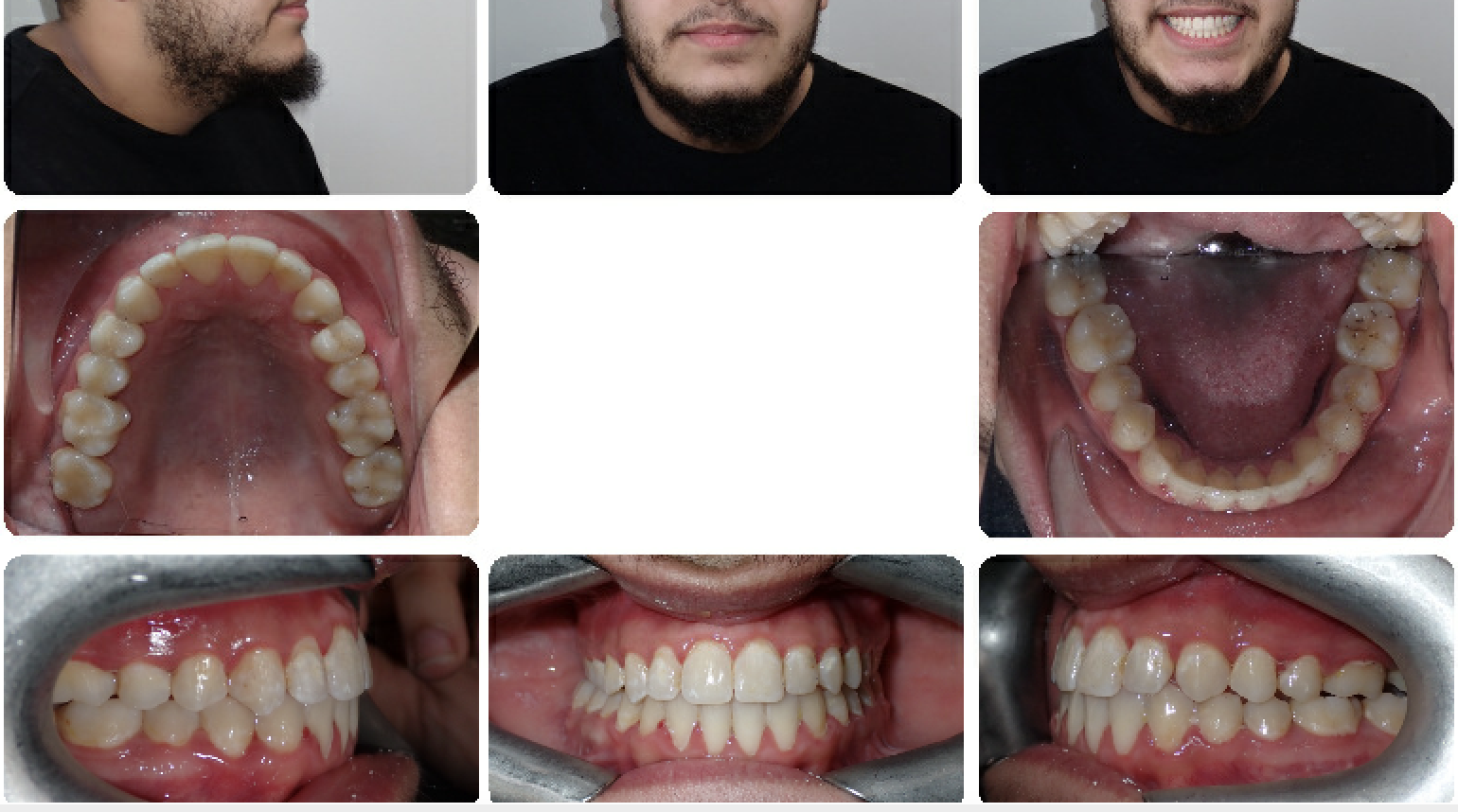 Class III Surgical — Final